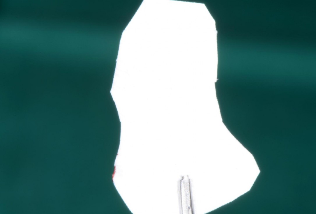 Ridge preservation with cerabone® Jason® membrane - Dr. D. Jelušić